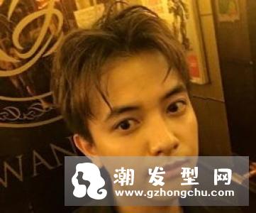 M型发际线适合的发型 这么剪拯救发际线提升颜值