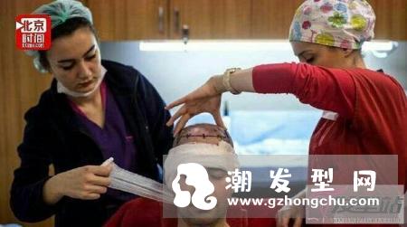 印度富商植发过敏身亡 植发的这些风险你和危害你必须懂