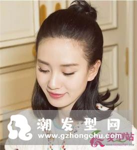 发际线越来越后移 什么原因导致掉发