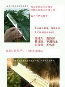 接发方式有哪些 可以染烫吗
