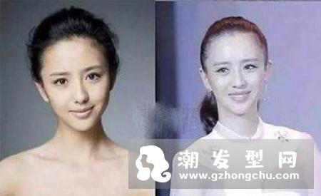 发际线怎样算高 和额头饱满的区别