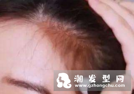 眉粉可以当发际线粉吗 怎么用