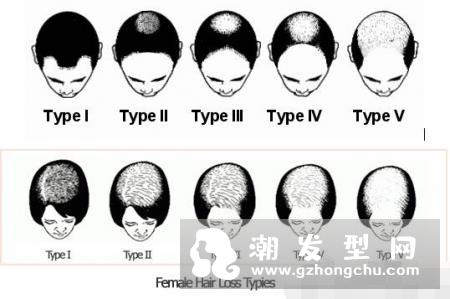 柳屋生发水真的生发吗 柳屋生发水的成分分析