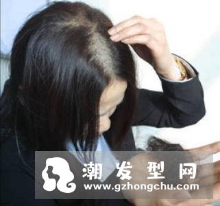 怎样洗头才是正确的 女生头发护养方法