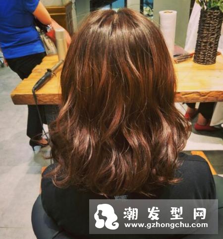 头皮上抠出白色小颗粒是什么东西 头发根部有白色颗粒怎么办