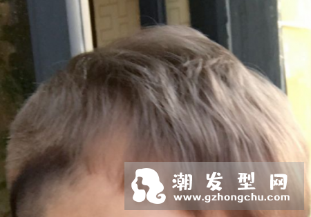 青木亚麻灰褪色后什么颜色 需要漂白吗