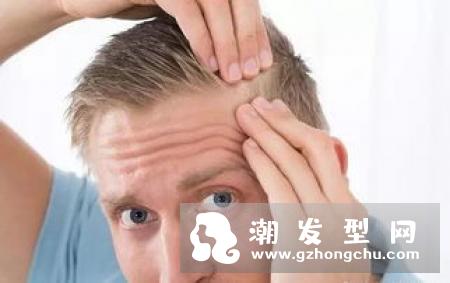 脂溢性脱发洗发水 洗发水真的治疗脂溢性脱发吗