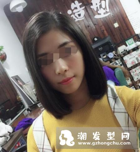 头皮上抠出白色小颗粒是什么东西 头发根部有白色颗粒怎么办