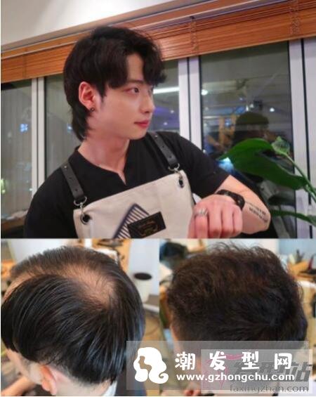 髮簪烫拯救各种秃头困扰 头发稀少秃头男士最佳烫发