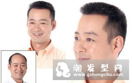 治疗脱发偏方早餐篇 早餐这么吃头发吸收营养效果最好