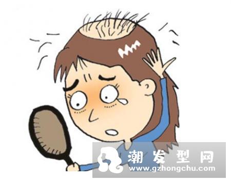 男性脱发吃什么好？预防脱发方法有哪些
