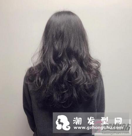 头皮屑特别多怎么办 注意好这些头皮屑无踪影