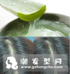 芦荟可以治疗脱发吗 芦荟护发液的制作方法