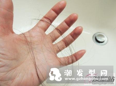 想改善脱发先从了解做起 分享有效预防掉发的五项小秘诀