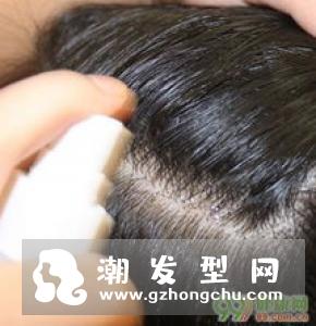 掉头发吃什么好 有助于预防和治疗脱发的食物