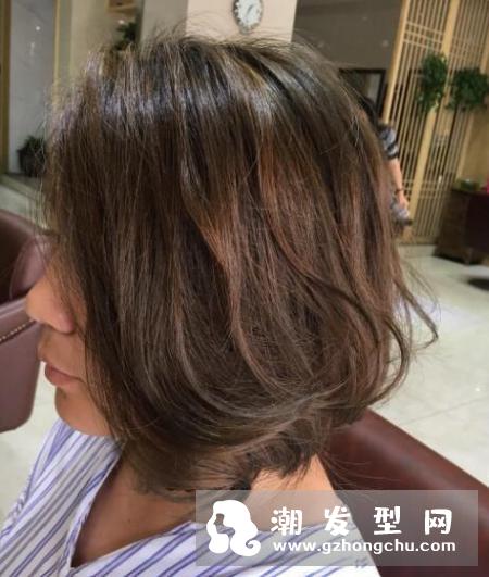 头屑是怎么形成的为什么难去除 头皮屑治疗小窍门