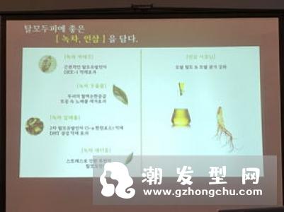 AMOS爱茉诗绿茶头皮洗发水适合油性发质吗 和干性发质的区别