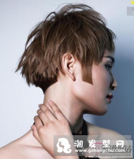 头皮发痒是什么原因 五个快速治头皮痒的方针