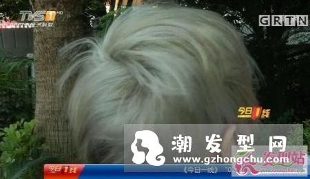 染奶奶灰头皮多处发红 染发前这些事项一定要注意