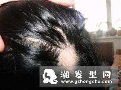梳头一直掉发？正确梳头 按摩能防止落发，还能帮助头皮纾压，超多好处请笔记！