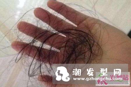 洗头老是掉头发怎么办 也许这些才是你掉头发的元凶