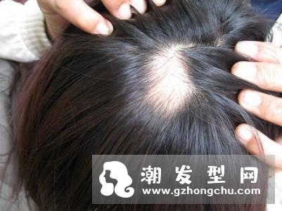 烫发染发后要怎么吹头和整理 受损过的头发不能用毛巾擦