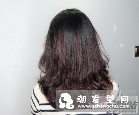 头皮发痒是什么原因 五个快速治头皮痒的方针