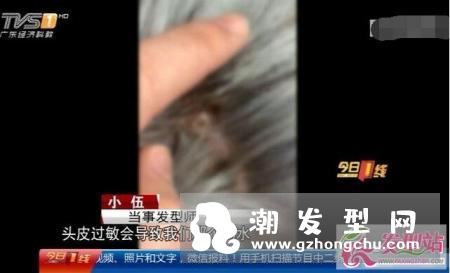 染奶奶灰头皮多处发红 染发前这些事项一定要注意