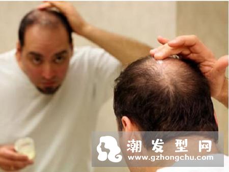 洗头老是掉头发怎么办 也许这些才是你掉头发的元凶