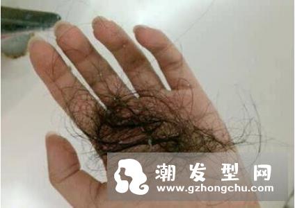 洗头掉头发正常吗 天天洗头真的会加剧脱发？