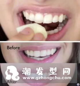 不同年龄段男生护发 男生最佳护发方法