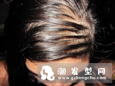 头发出油没时间洗头　保持头发干爽小妙招