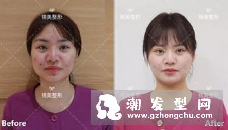 男学生做什么发型好看 韩式发型青春百搭塑造校园男神