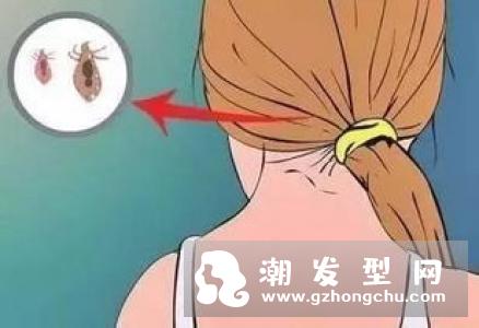 洗头掉多少头发正常 如果超出这个数你应该引起重视