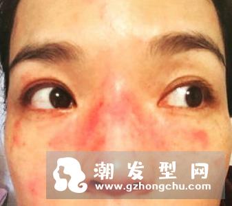 30秒判断你的头皮类型 油性干性头皮的护理技巧