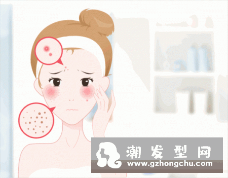 兰蔻小黑瓶用了长痘是什么原因 还能继续用吗