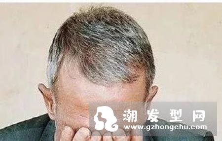 3个坏习惯导致白发掉发加剧 正确洗头发方法技巧