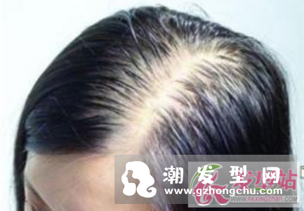 发型固定不变的危害 掉发脱发问题全解析