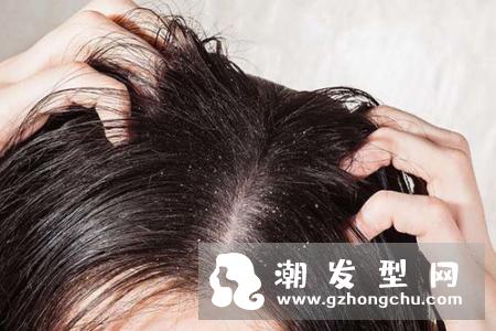 头发经常油腻怎么办 头发油腻的解决方法