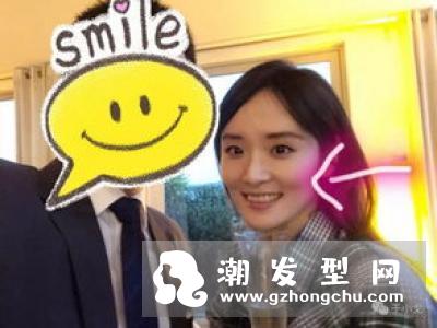 tripollar stop是什么品牌 林允同款美容仪价格多少钱