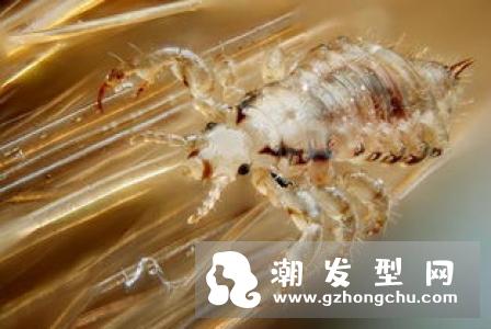 头虱的卵是白色的吗 怎么彻底去除