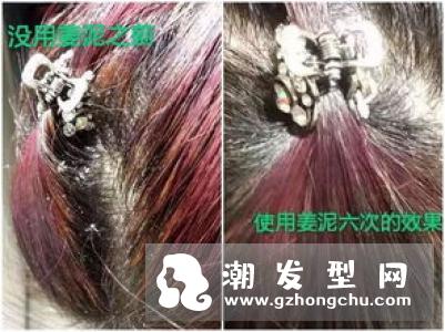 吃什么多头发好 拒绝头发干燥枯黄开叉头屑脱发食谱
