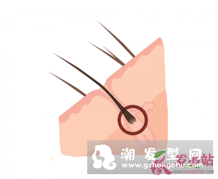 掉发脱发怎么办？女生洗头梳头掉发对策