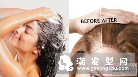 头皮出油、干痒、头皮屑狂掉？4招护理秘诀，养好头皮才有秀发！