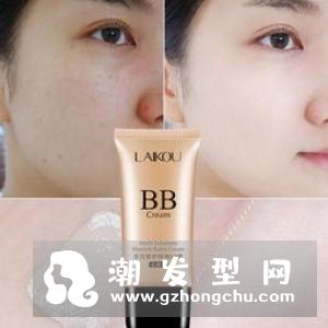 中华神皂可以去螨虫吗 多少钱一块