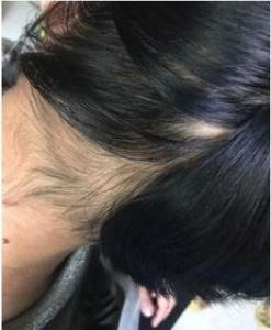 光头可以戴假发吗 容易掉吗