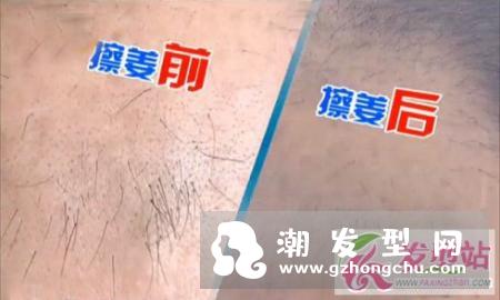 脱发用生姜擦有用吗 民间治疗脱发偏方值得一试