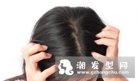 头发刚洗完就痒怎么办 这是没有洗干净的节奏