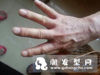 鲜为人知的生发偏方 四个护发生发小窍门