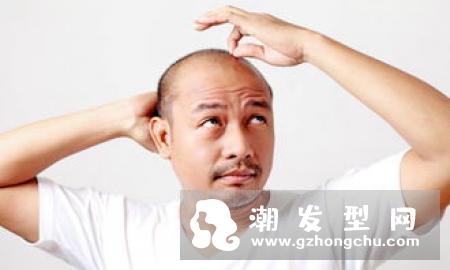 夏天为什么掉头发严重 影响夏季脱发的原因有哪些